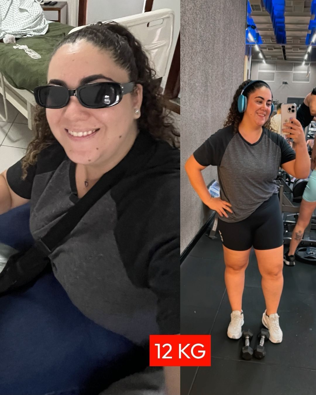 Antes / Depois