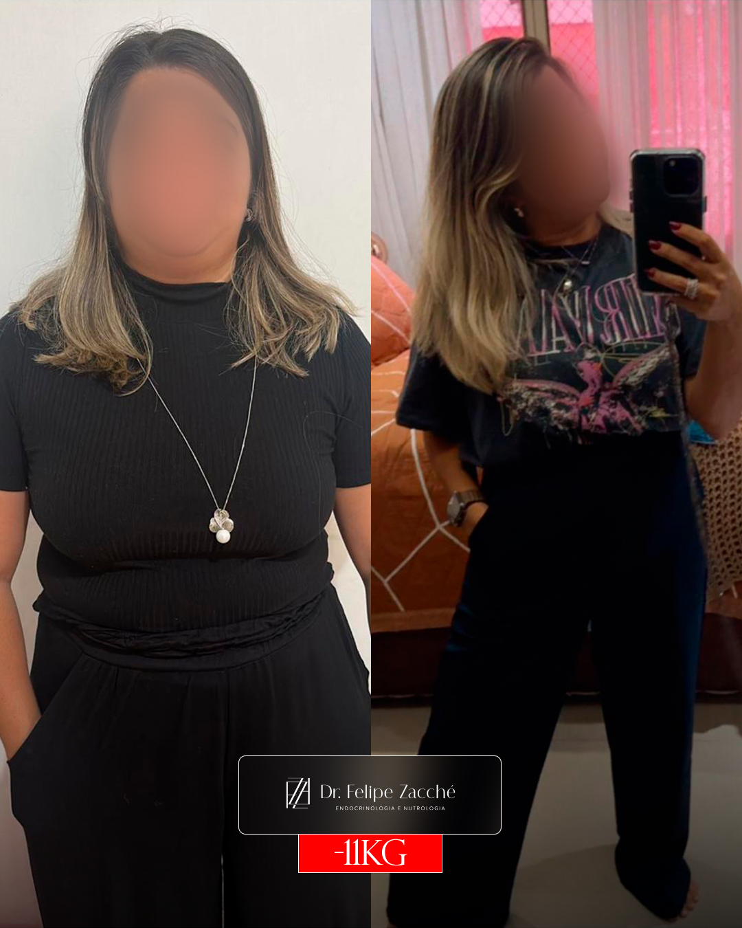 Antes / Depois