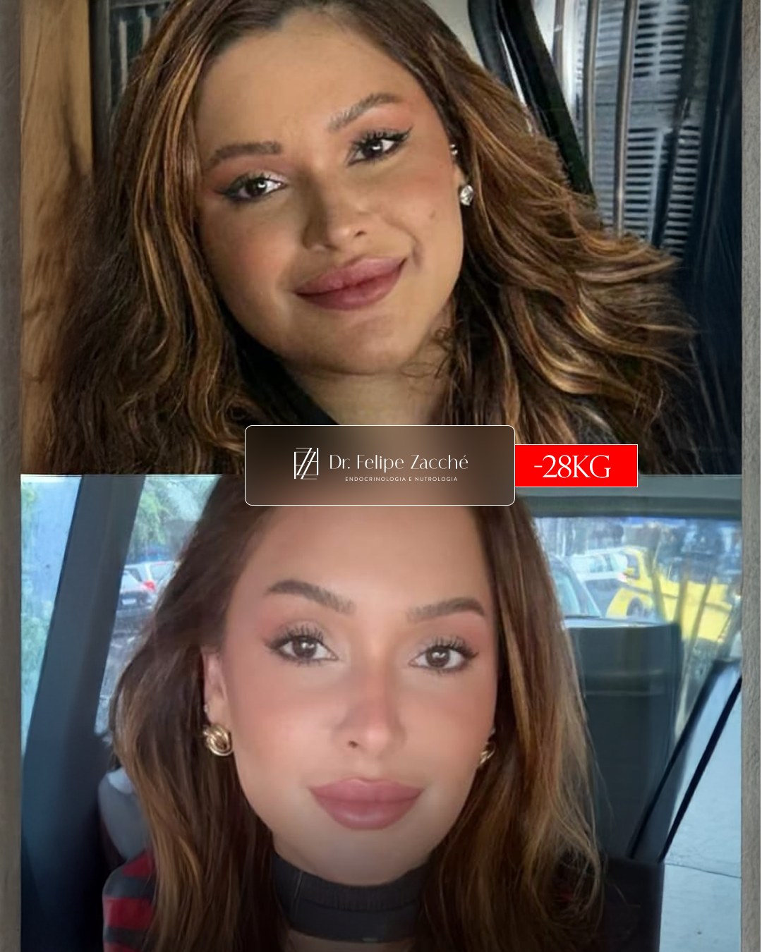 Antes / Depois
